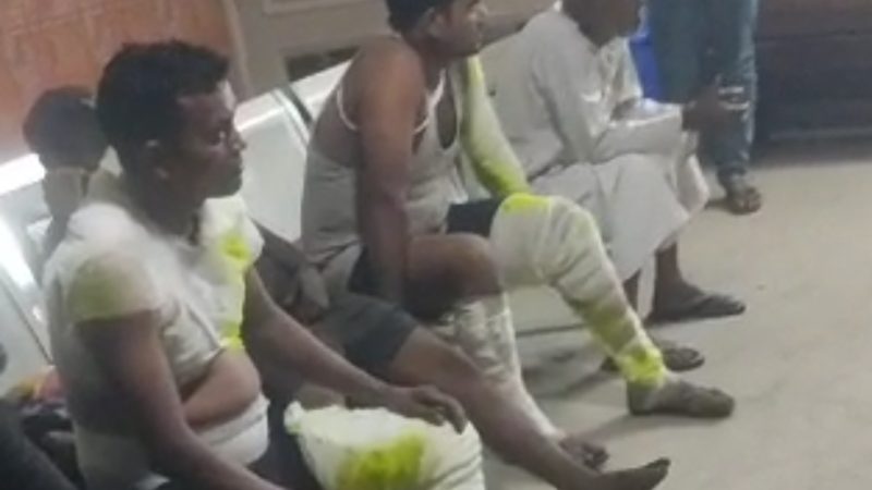 रुड़की की स्टील फैक्ट्री में रात को हुआ जोरदार धमाका, कई कर्मचारी घायल हो, यूपी के अस्पताल मे कराया भर्ती।