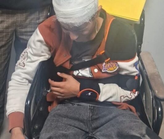 कश्मीरी किशोरों पर सांप्रदायिक हमला, लोहे की रॉड से पीटा गया, एक की हालत गंभीर।